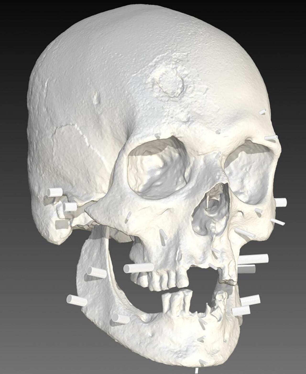 [IMAGE] 19th Century New England Vampire Undergoes 21st Century DNA Analysis