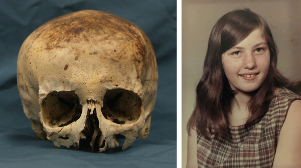 Skull [Left] of Wanda Ann Herr [Right]